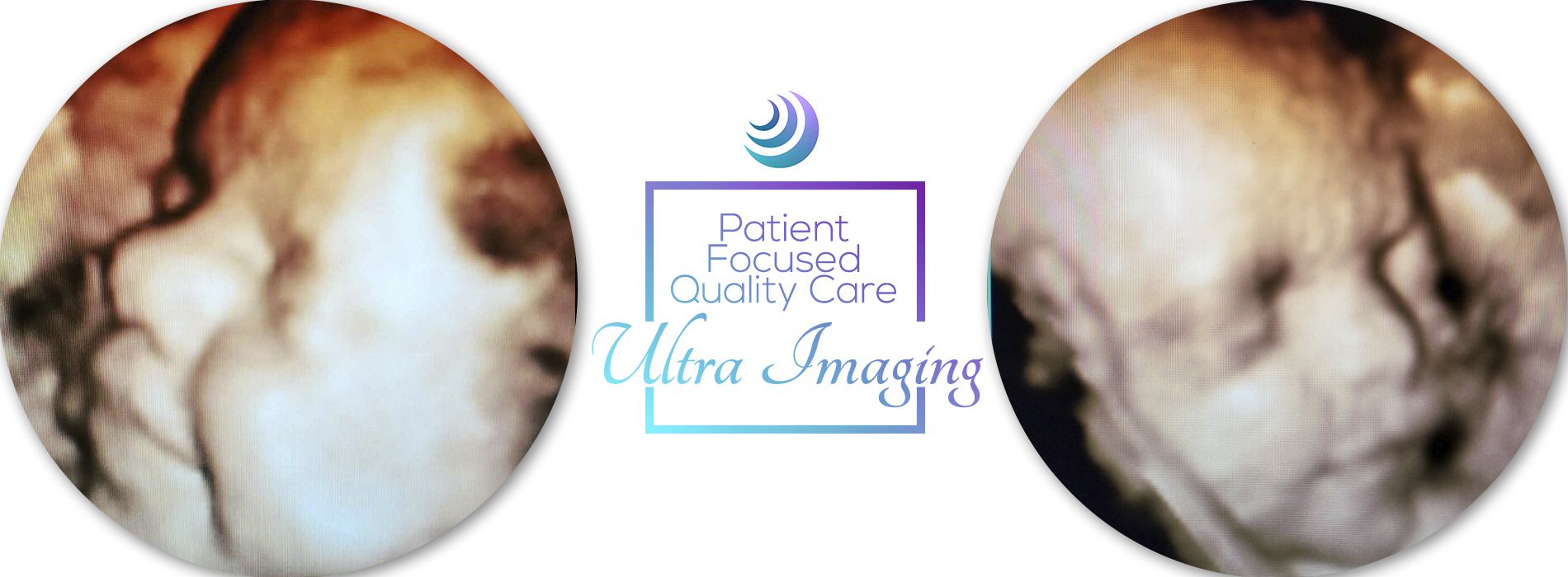 UltraSound Visalia - Slider